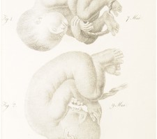 Afbeelding uit: "Volledige verzameling van afbeeldingen uit den geheelen omvang der theoretische en practische verloskunde, met eene uitvoerige beschrijvende verklaring derzelve", door J.P. Maygrier, 1838
